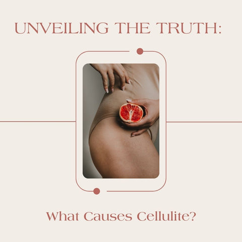 Unveiling the Truth: What Causes Cellulite?