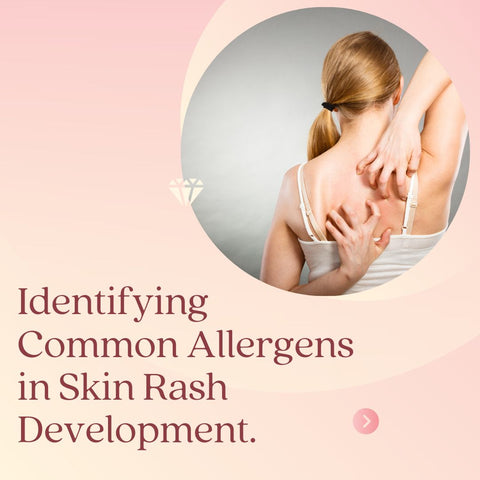 Identifying Common Allergens in Skin Rash Development