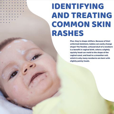 Identifying and Treating Common Skin Rashes