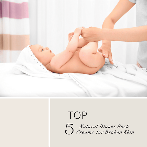 Top 5 Natural Diaper Rash Creams for Broken   Skin