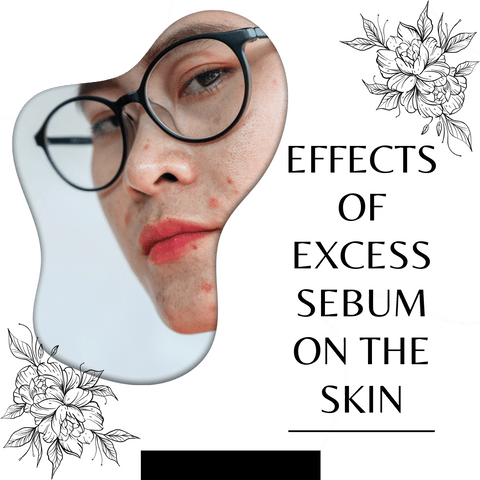 Effects of Excess Sebum on the Skin