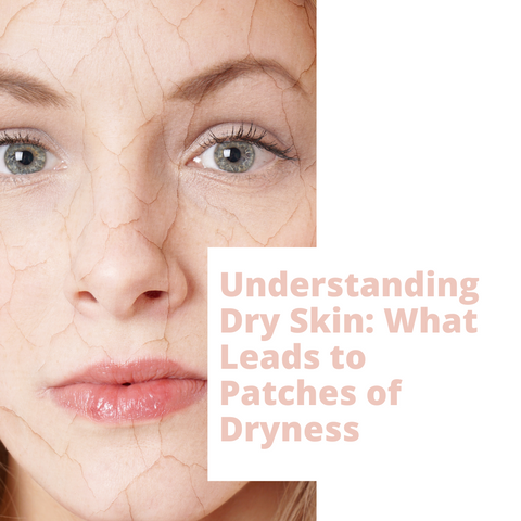 Understanding Dry Skin: What Leads to Patches of Dryness