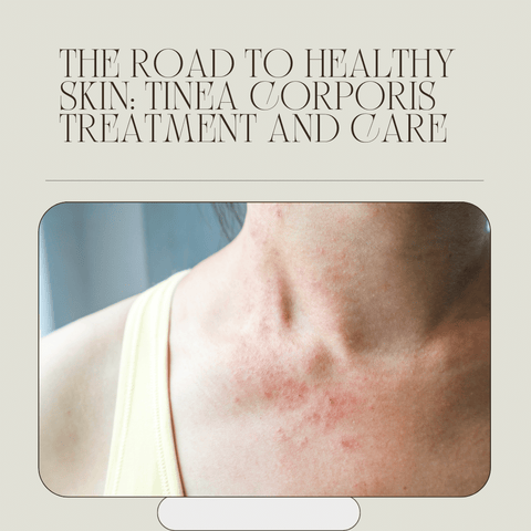 The Secrets of Tinea Corporis and Glowing Skin