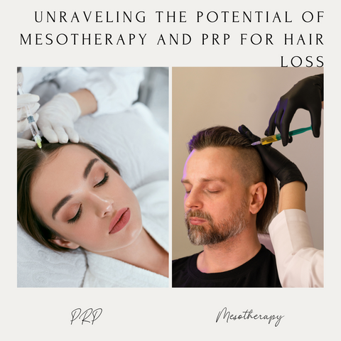 Unraveling the Potential of Mesotherapy and PRP for Hair Loss