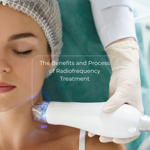 The Benefits and Process of Radiofrequency Treatment