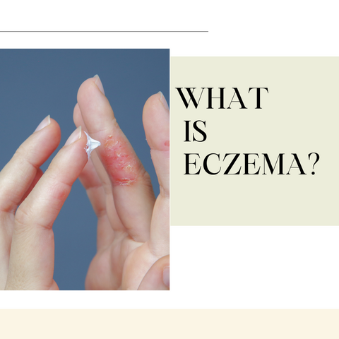 How to Dress for Outdoor Winter Activities if You Have Eczema