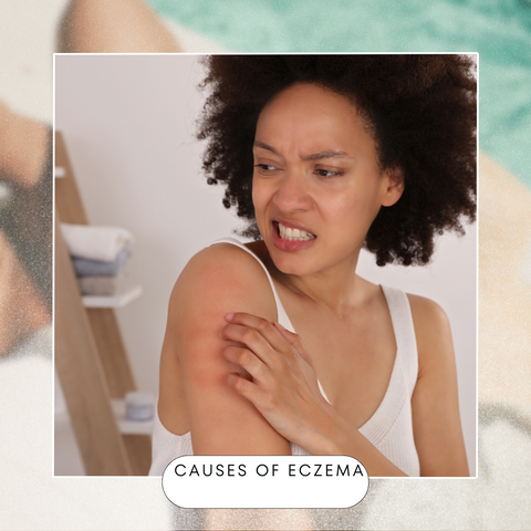 Causes of eczema