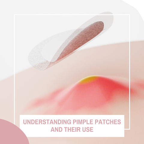 Understanding Pimple Patches and Their Use