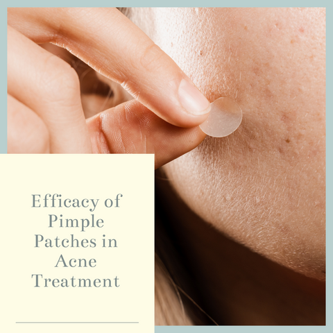 Efficacy of Pimple Patches in Acne Treatment