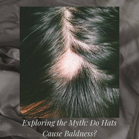 Exploring the Myth: Do Hats Cause Baldness?