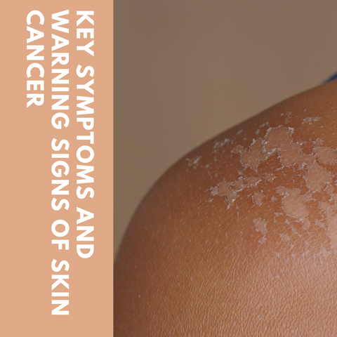 Key Symptoms and Warning Signs of Skin Cancer