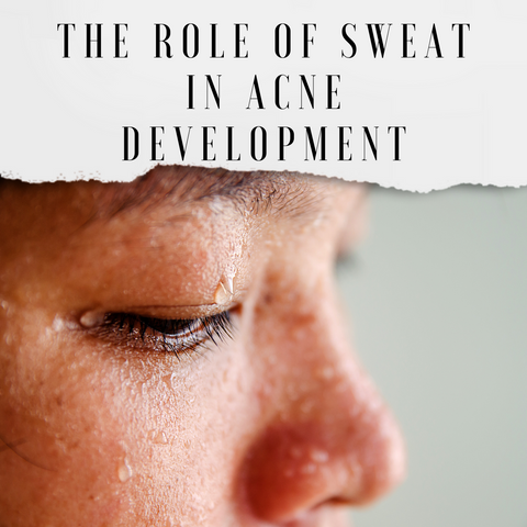 The Role of Sweat in Acne Development