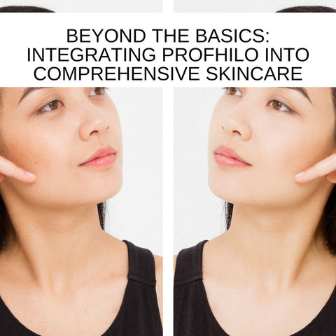 Beyond the Basics: Integrating Profhilo into Comprehensive Skincare