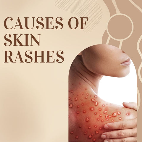 Causes of skin rashes