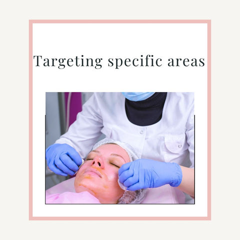 #2 Targeting specific areas