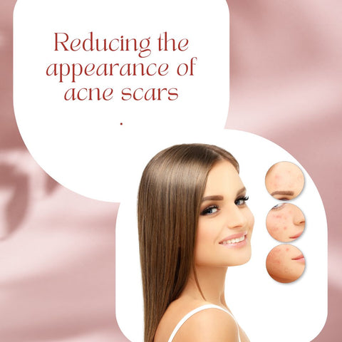 #4 Reducing the appearance of acne scars