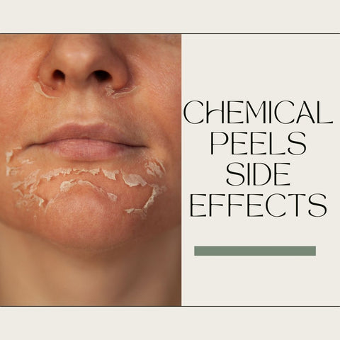 Chemical peels side effects