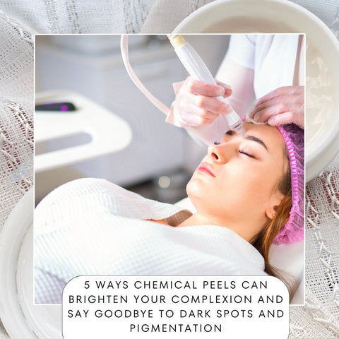 5 ways chemical peels can brighten your complexion and say goodbye to dark spots and pigmentation