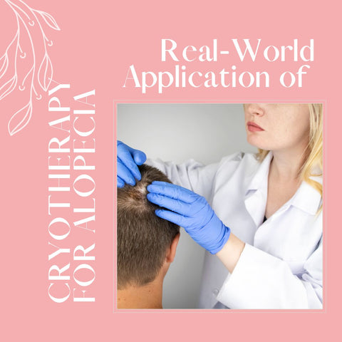 Real-World Application of Cryotherapy for Alopecia