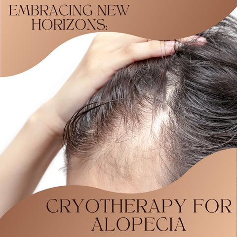 Embracing New Horizons: Cryotherapy for Alopecia