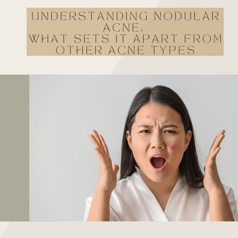 Understanding Nodular Acne: What Sets It Apart from Other Acne Types