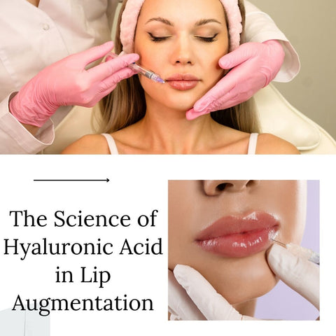 The Science of Hyaluronic Acid in Lip Augmentation