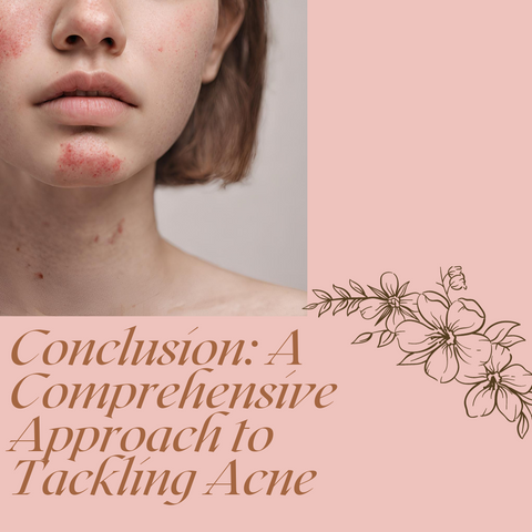 Conclusion: A Comprehensive Approach to Tackling Acne