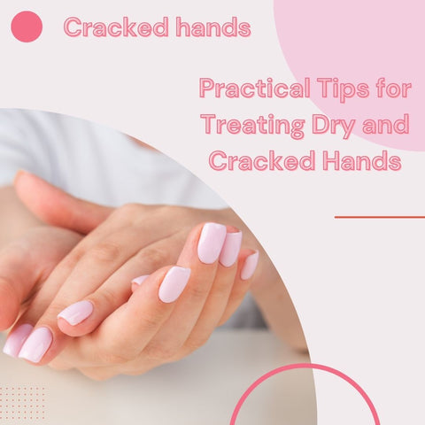 Practical Tips for Treating Dry and Cracked Hands
