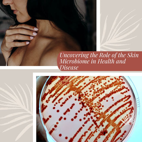 Strategies to Balance the Skin Microbiome for Clear Skin