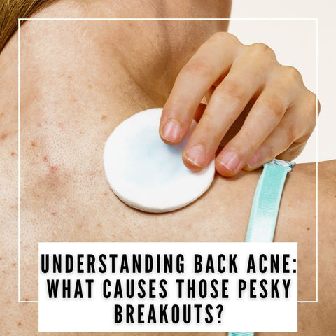 Understanding Back Acne: What Causes Those Pesky Breakouts?