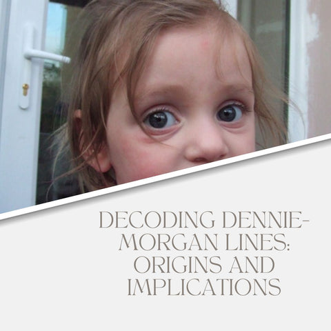 Decoding Dennie-Morgan Lines: Origins and Implications