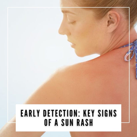 Early Detection: Key Signs of a Sun Rash