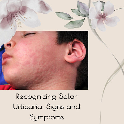 Recognizing Solar Urticaria: Signs and Symptoms