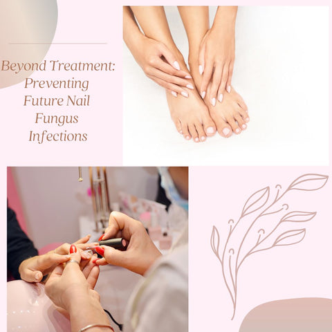 Beyond Treatment: Preventing Future Nail Fungus Infections