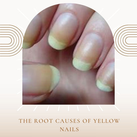 The Root Causes of Yellow Nails