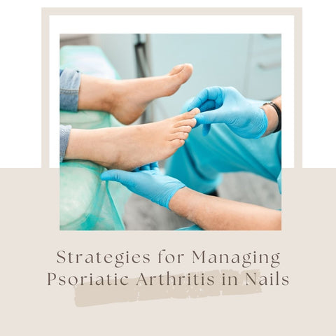 Strategies for Managing Psoriatic Arthritis in Nails