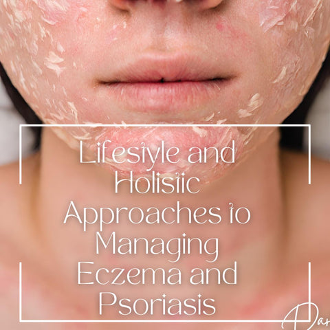 Lifestyle and Holistic Approaches to Managing Eczema and Psoriasis