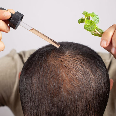 Lifestyle and Home Remedies for Male Pattern Baldness