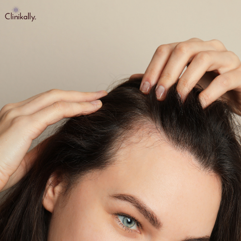 Is benzophenone-4 safe for hair?