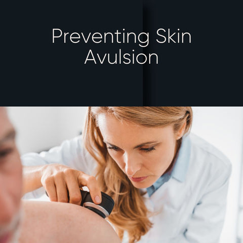 Preventing Skin Avulsion