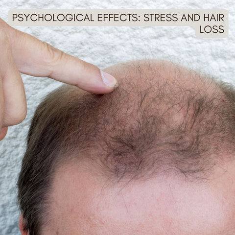 Psychological Effects: Stress and Hair Loss