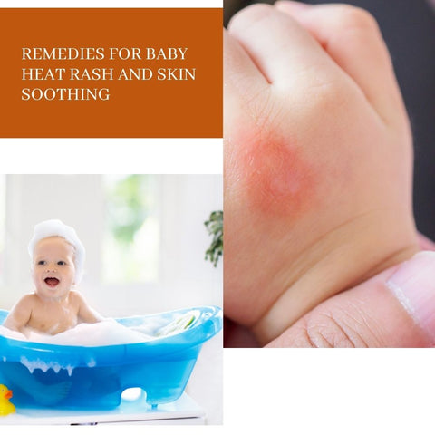 Remedies for baby heat rash and skin soothing