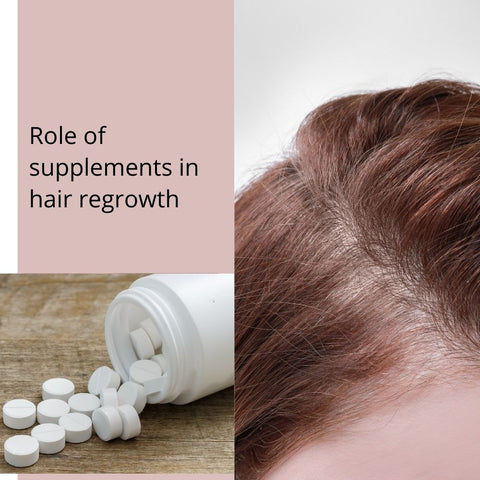 Role of supplements in hair regrowth