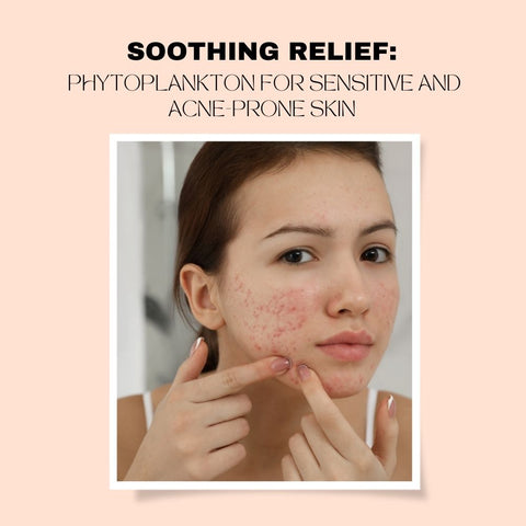 Soothing Relief: Phytoplankton for Sensitive and Acne-Prone Skin
