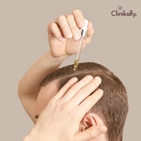 Summarizing the key benefits of using topical finasteride for hair regrowth
