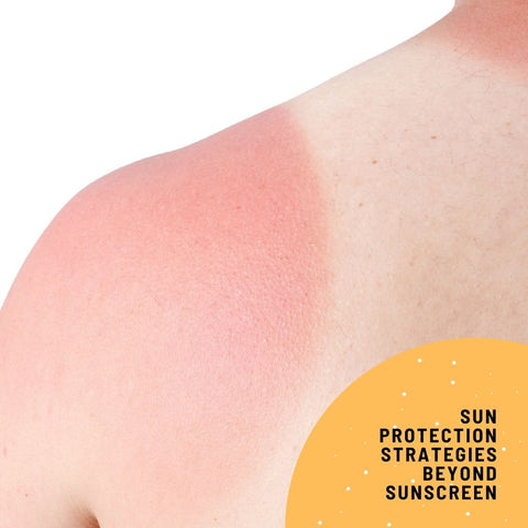 Sun Protection Strategies Beyond Sunscreen