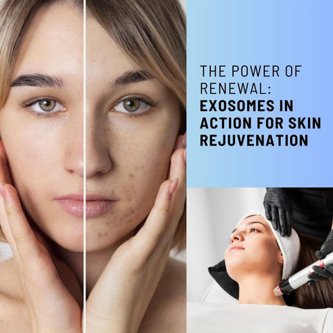 The Power of Renewal: Exosomes in Action for Skin Rejuvenation