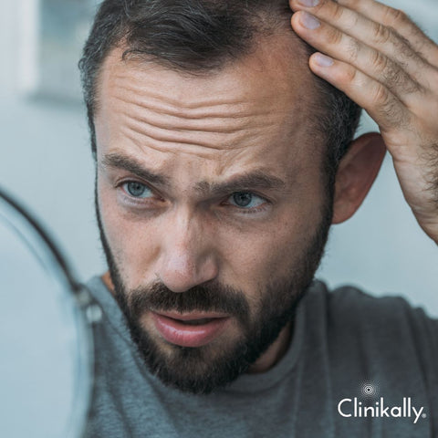 The psychological impact of hair loss