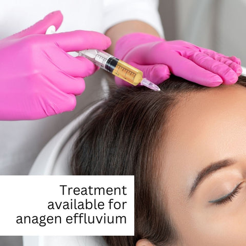 Treatment available for anagen effluvium