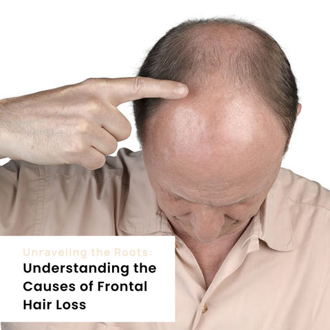 Unraveling the Roots: Understanding the Causes of Frontal Hair Loss